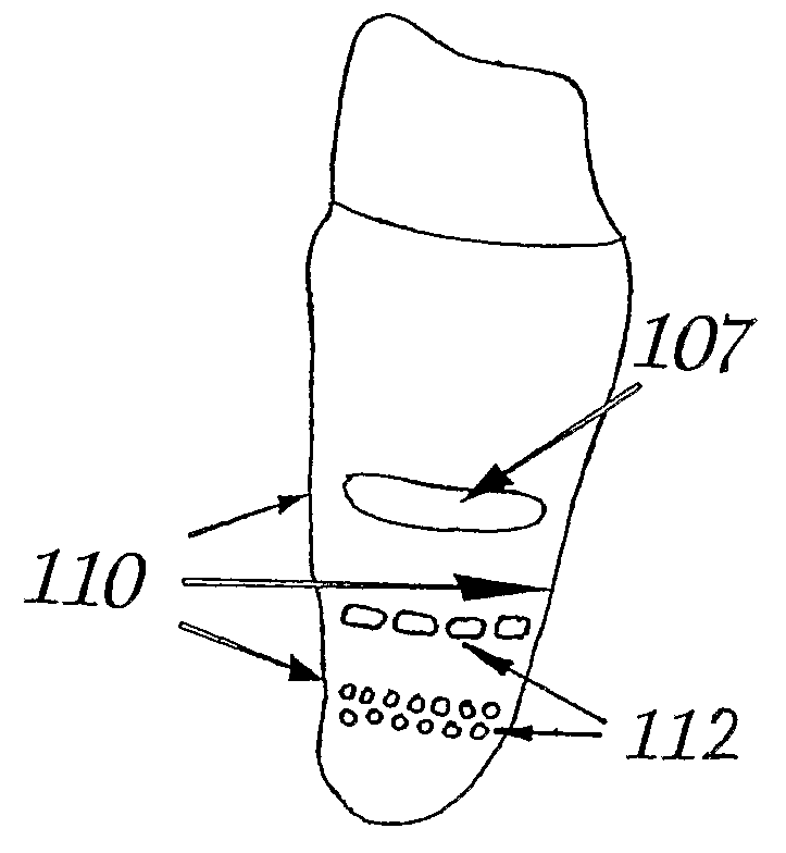 Tooth Implant