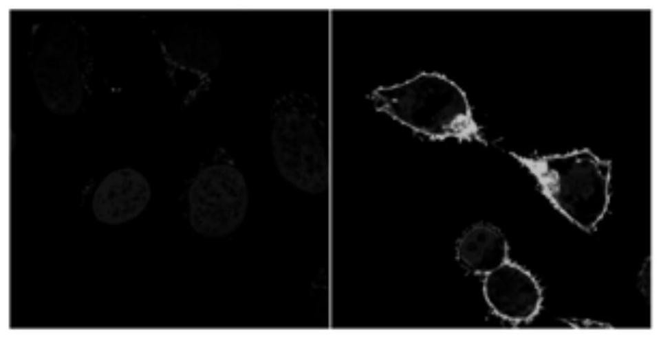 Novel coronavirus pneumonia recombinant human type 5 adenovirus vaccine