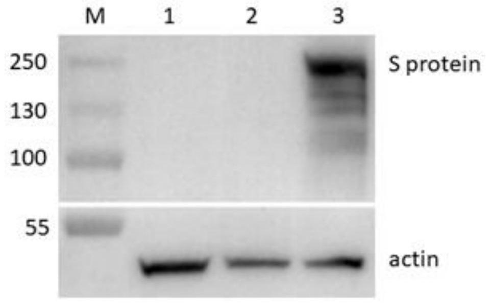 Novel coronavirus pneumonia recombinant human type 5 adenovirus vaccine