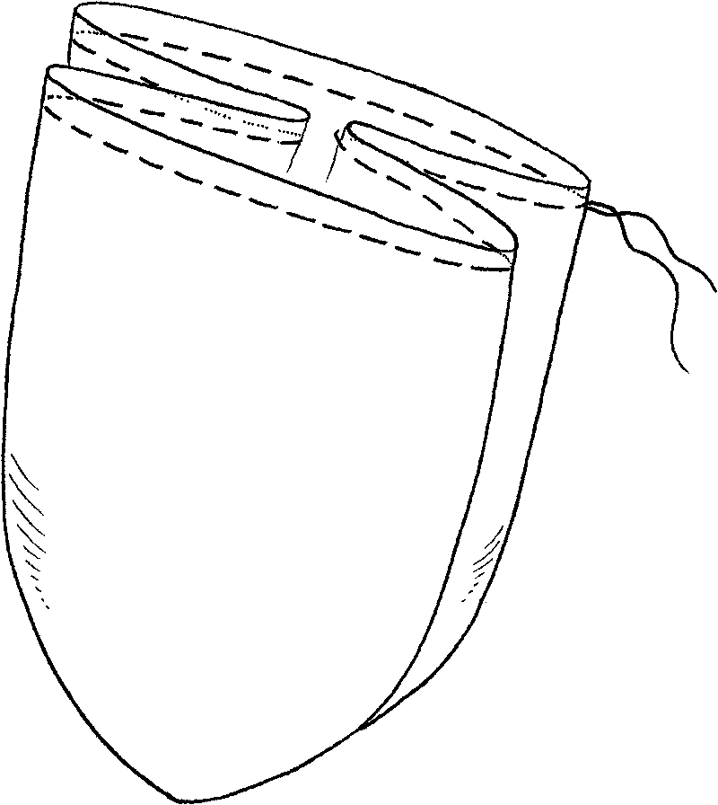 Foldable internal-cutting removing device for minimally invasive operation excision objects