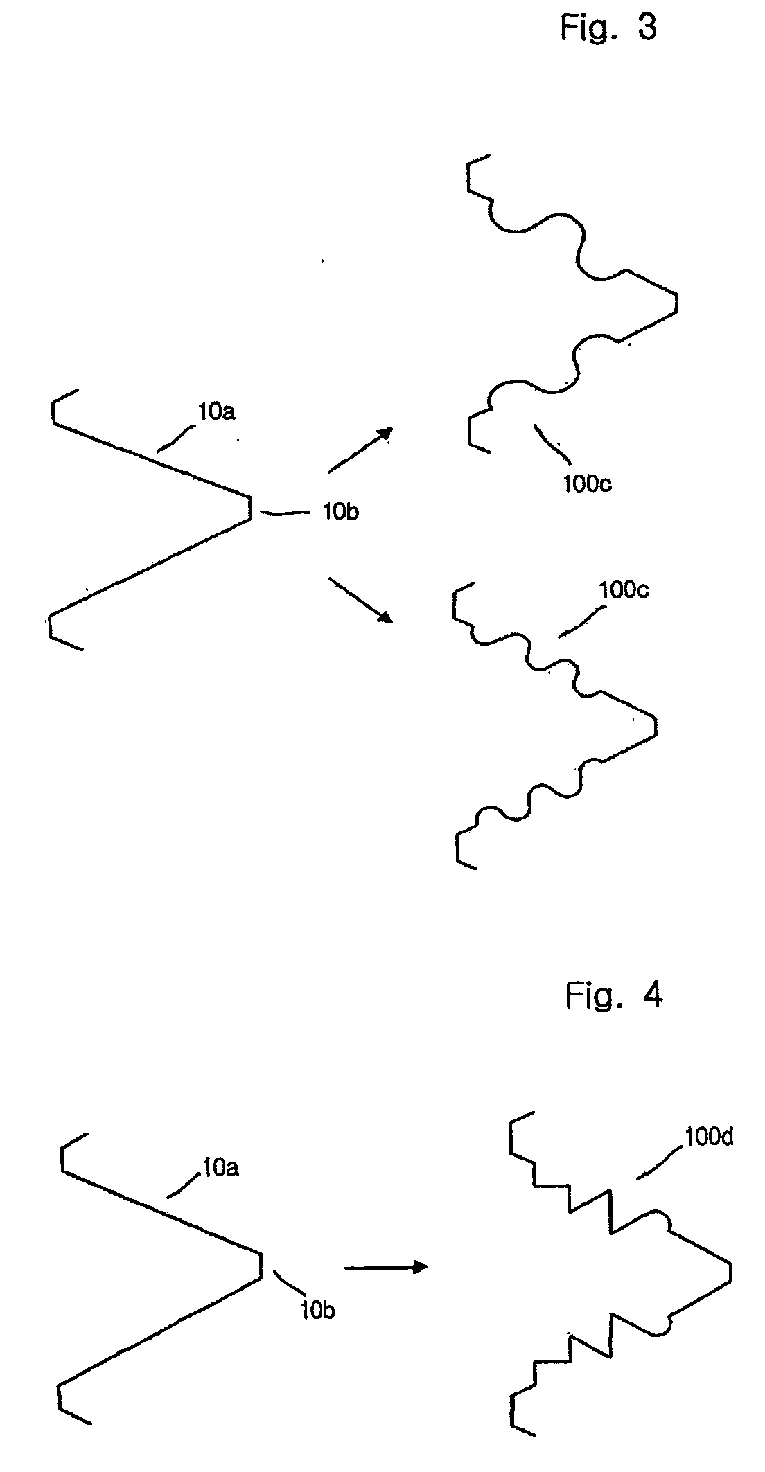 Helical implant