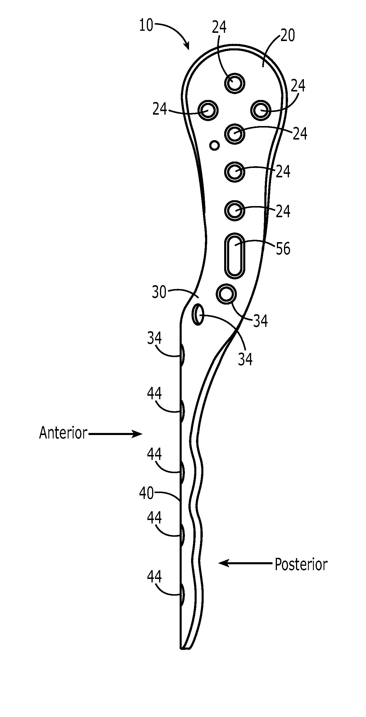 Proximal humeral fracture plate