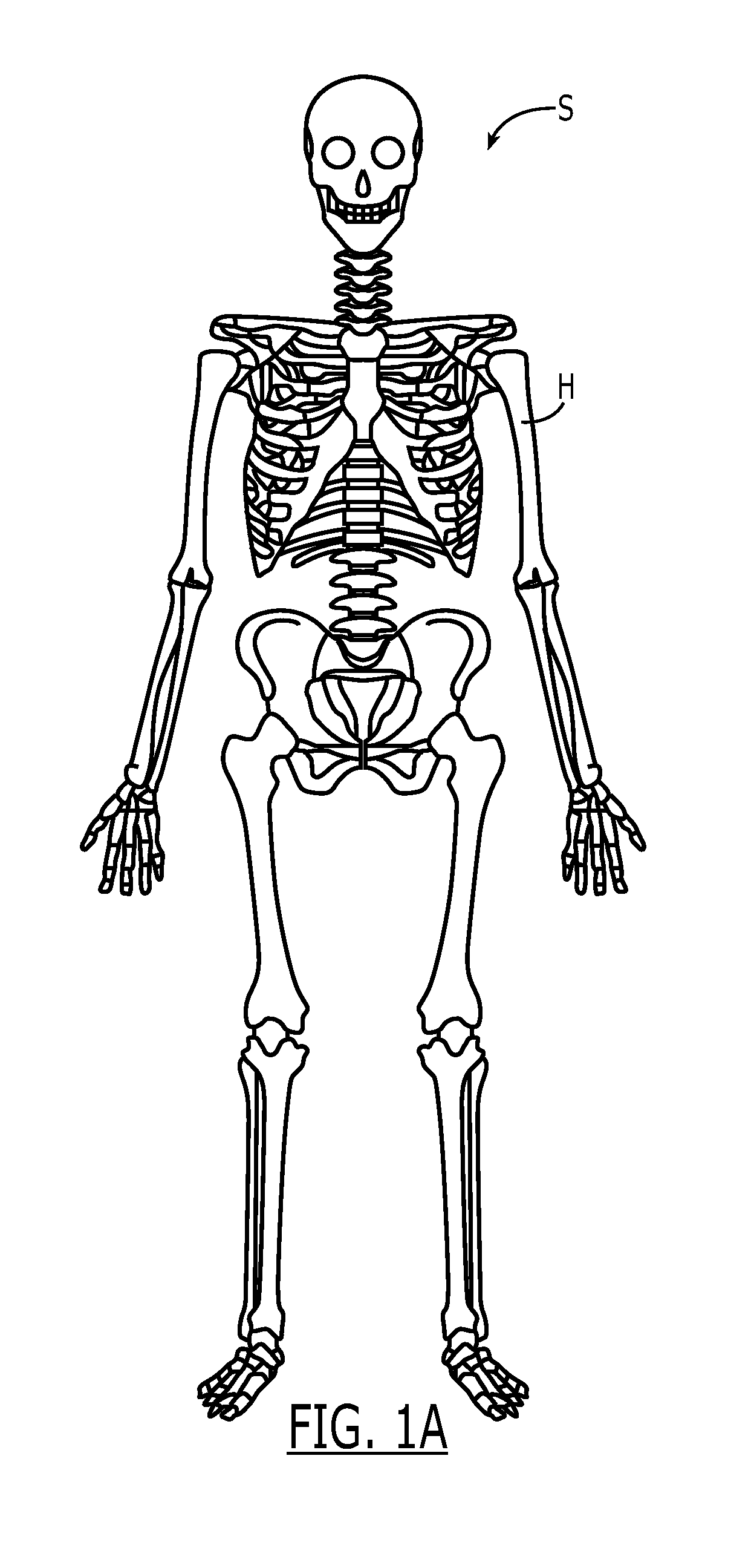 Proximal humeral fracture plate