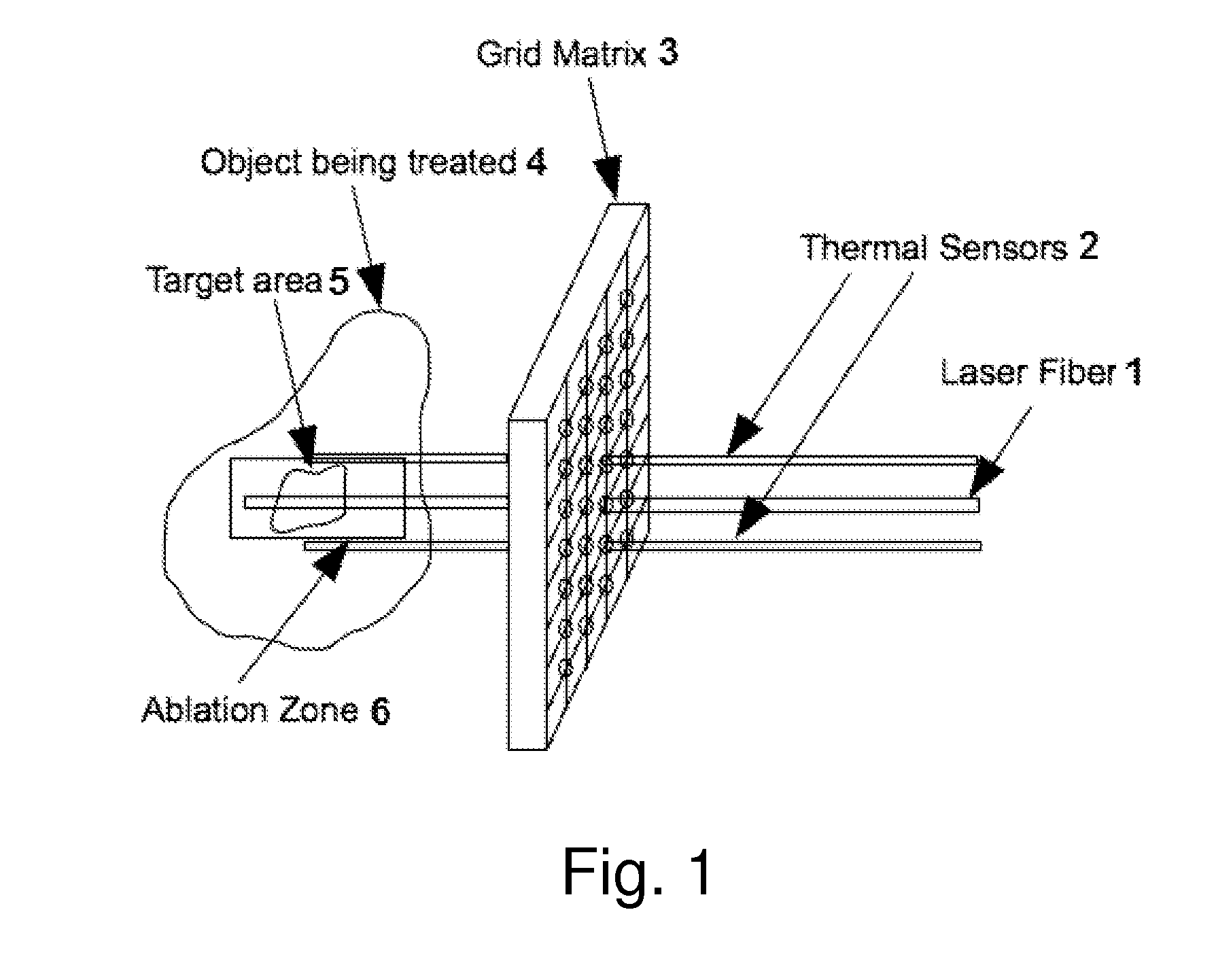 Method and apparatus for laser ablation under ultrasound guidance