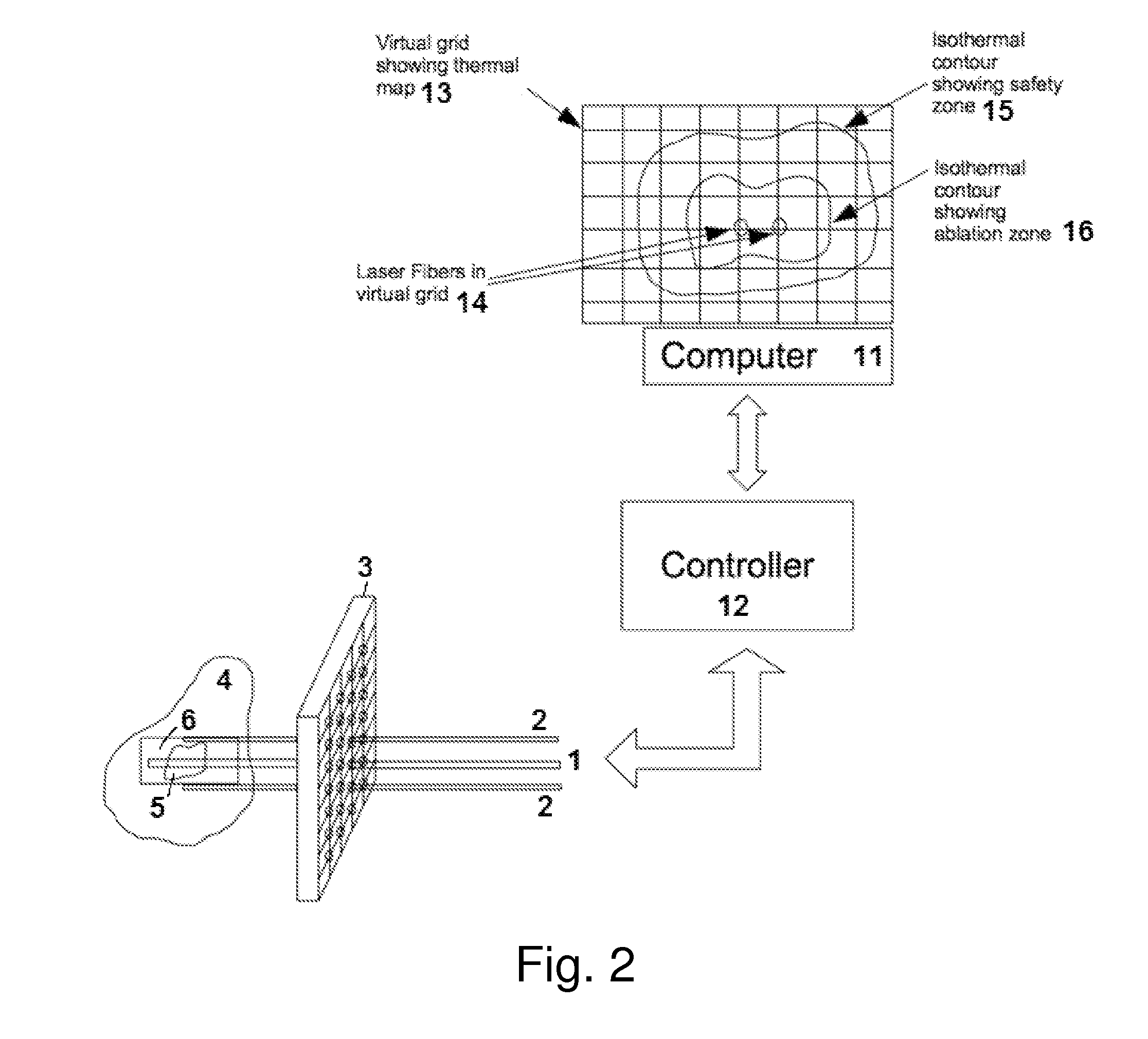 Method and apparatus for laser ablation under ultrasound guidance