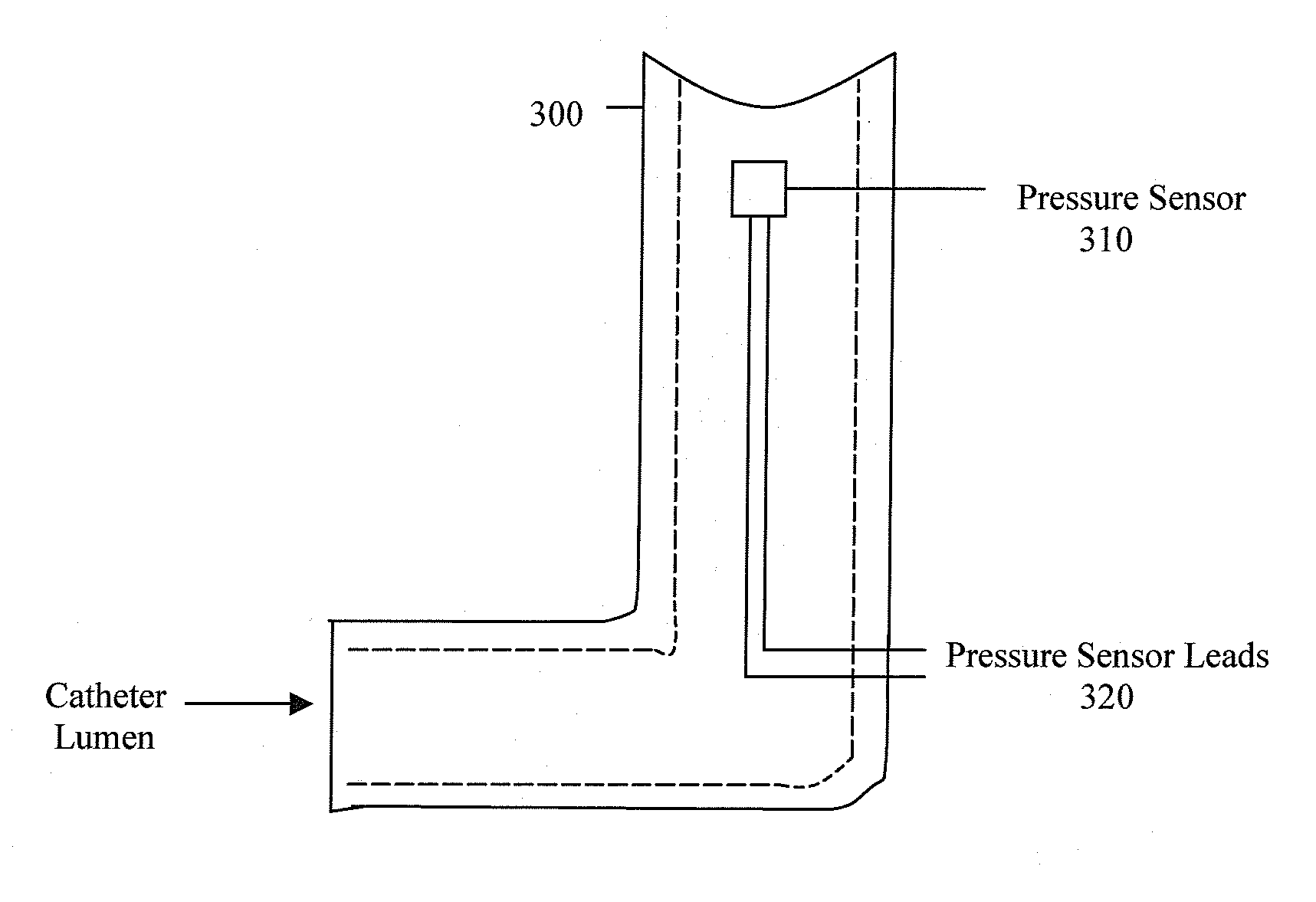 Involuntary Contraction Induced Pressure as a Medical Diagnostic Tool