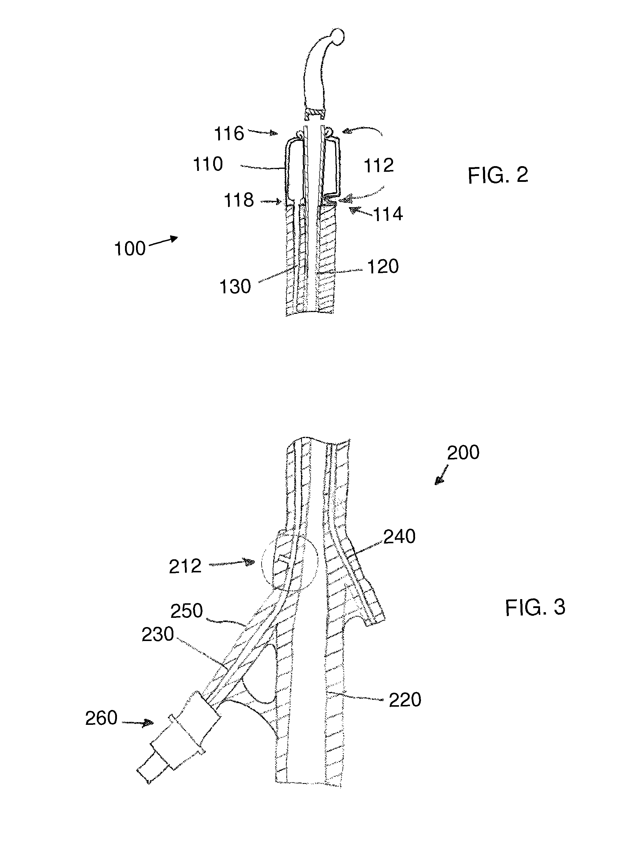 Stretch valve balloon catheter and methods for producing and using same