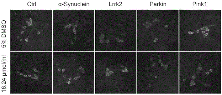 Application of trametinib in preparation of drug for treating Parkinson's disease