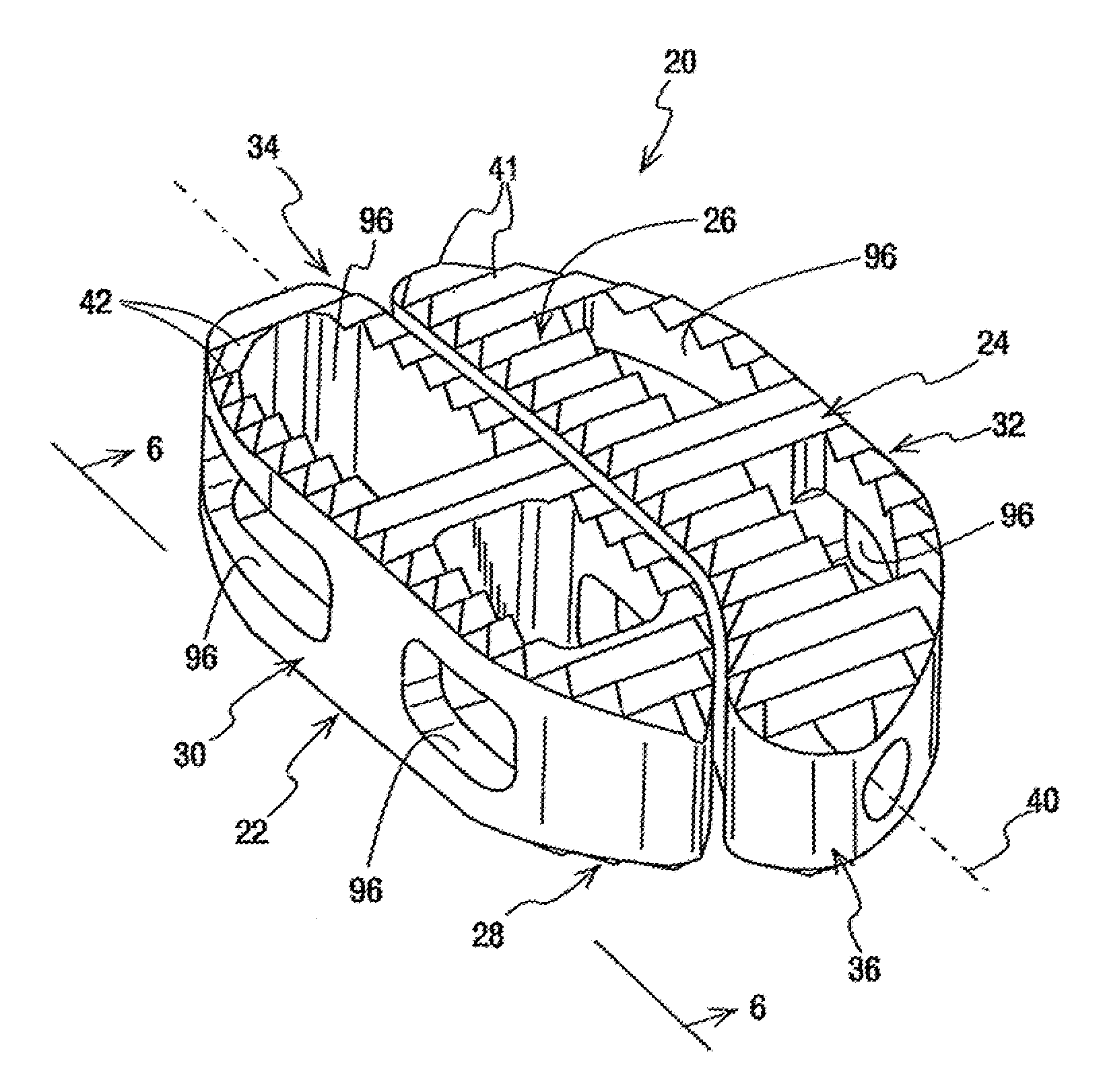 Interbody implant