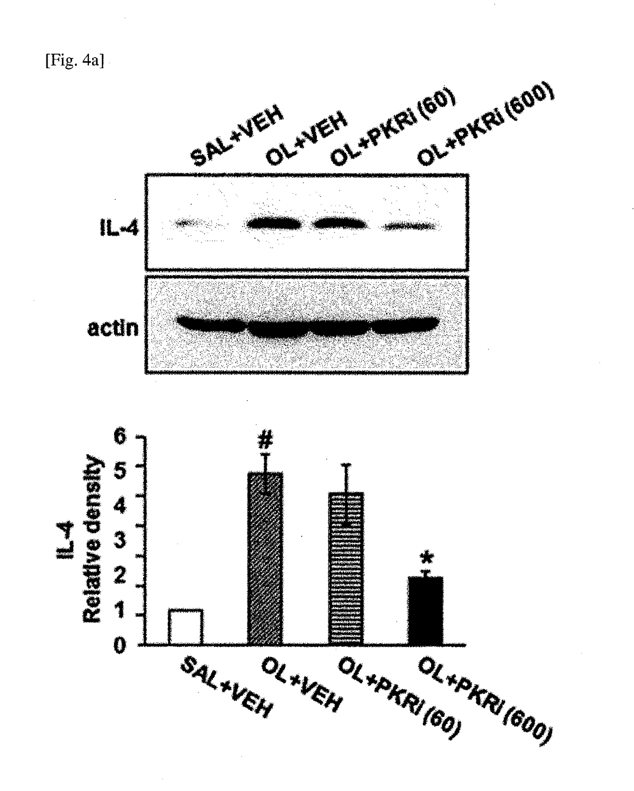 Composition for prevention or treatment of bronchial asthma comprising pkr inhibitor as active ingredient