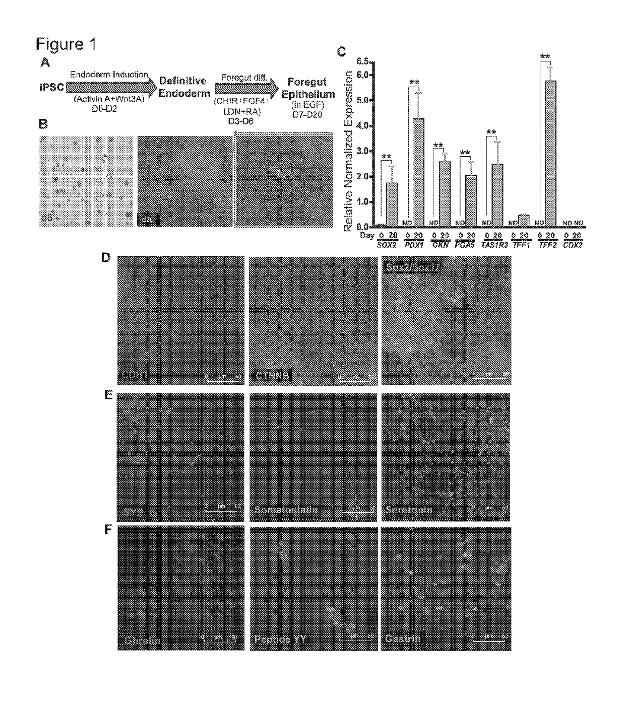 Systems and methods for growth of intestinal cells in microfluidic devices