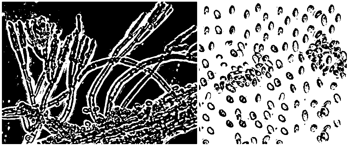 Bionectria ochroleuca Bo-1 strain, cultures thereof, and applications of the strain and the cultures thereof in resisting pathogenic bacteria