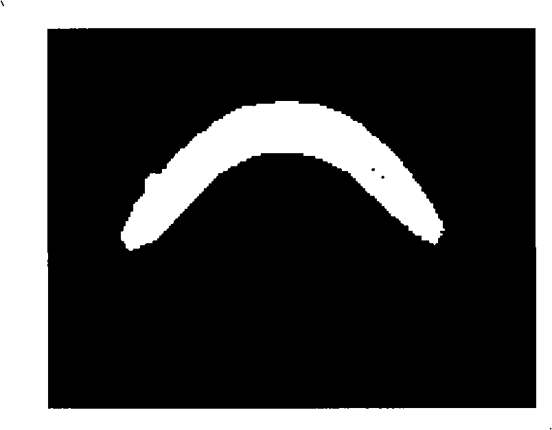 Method for processing human jaw facial bone CT image digitalization based on inheritance algorithm