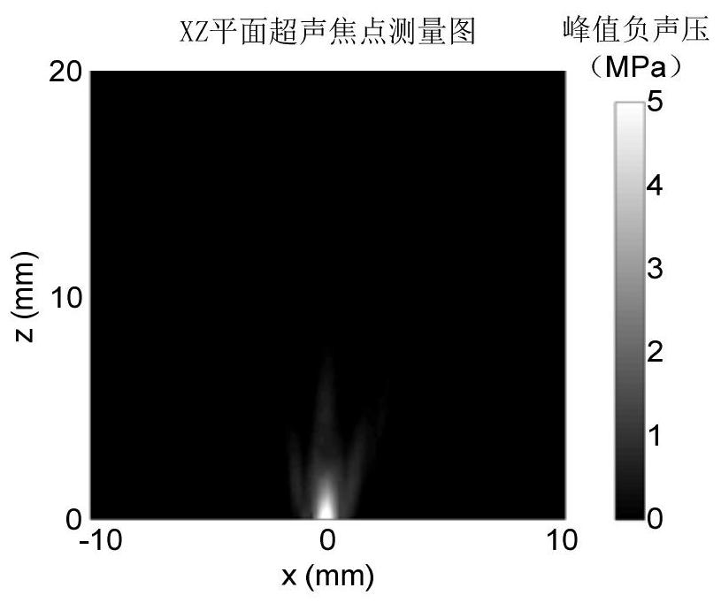 A vaccine transdermal delivery device based on acoustically induced microwell array