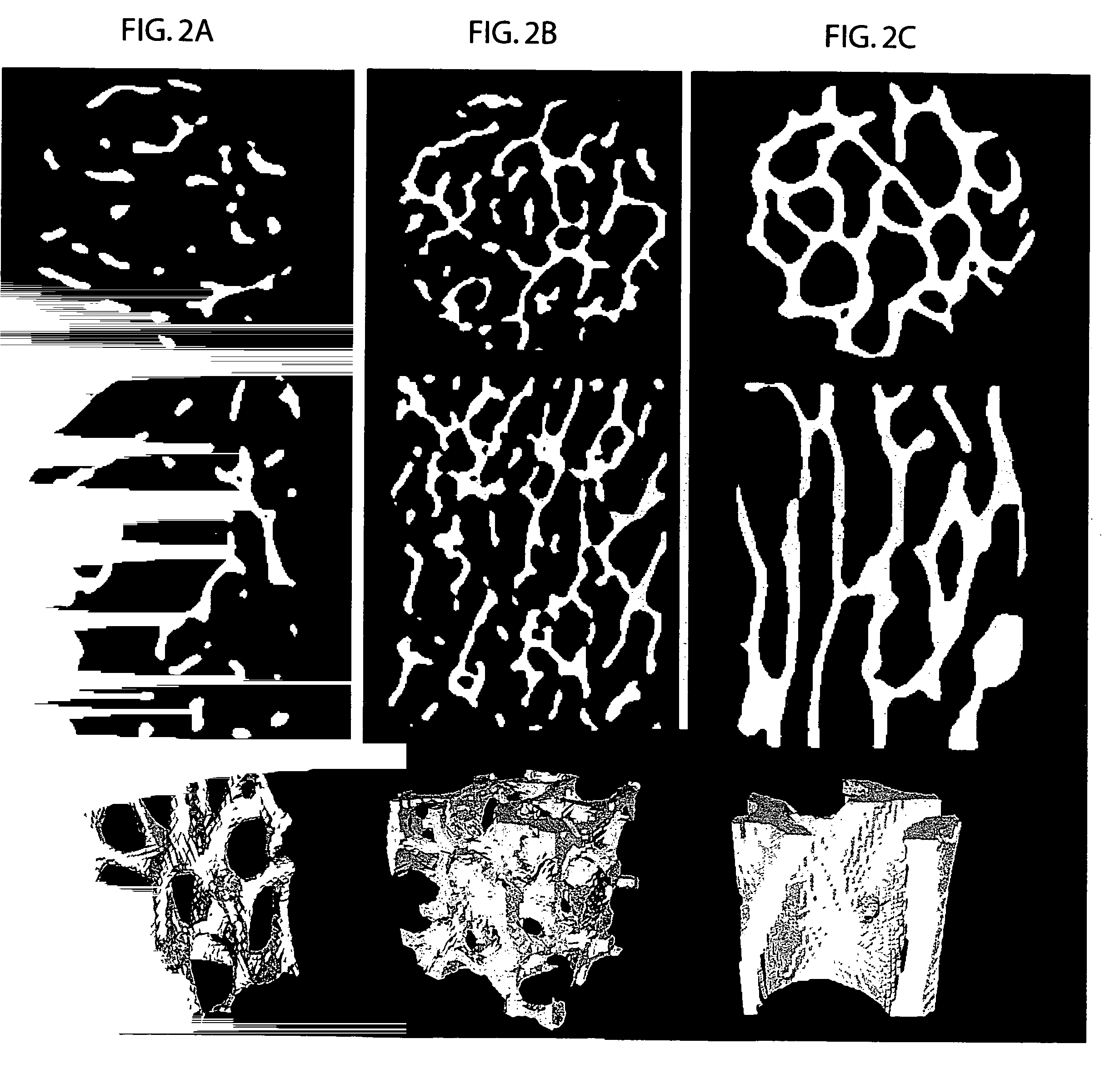 Diffusion-based magnetic resonance methods for characterizing bone structure