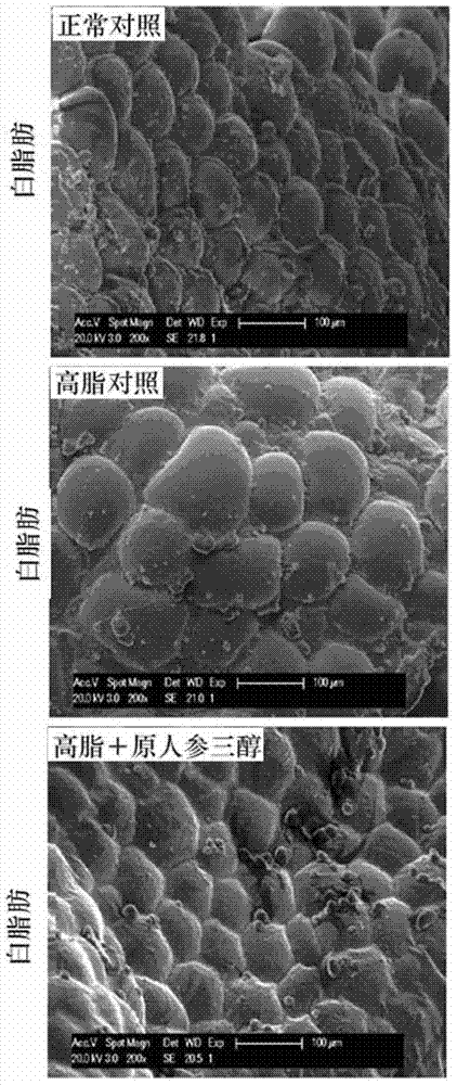 Pharmaceutical use of protopanaxatriol or/and derivatives thereof