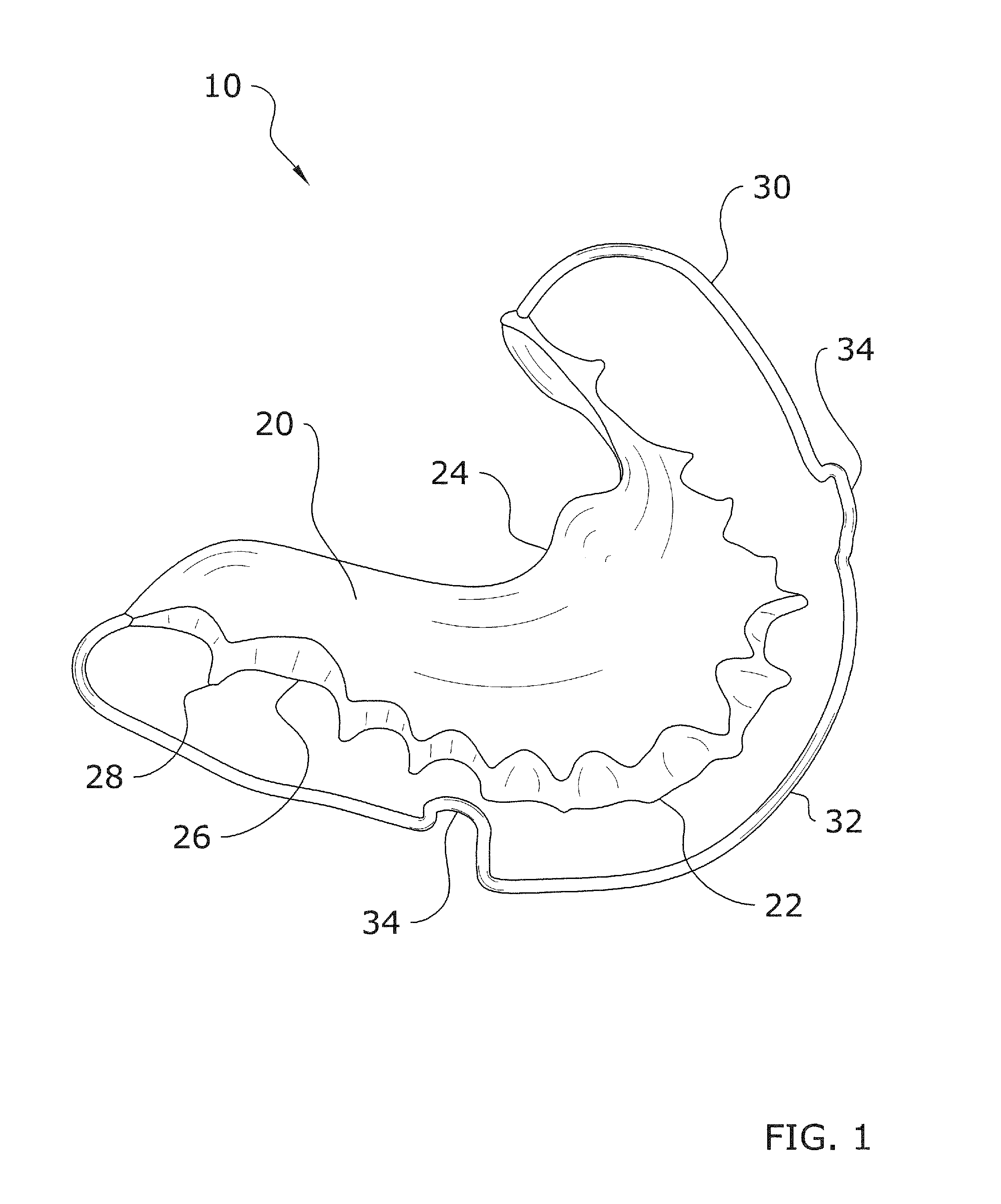 Cast orthodontic retainer system