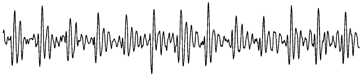 A method for analyzing cardiac shock signals to calculate short-term heart rate values