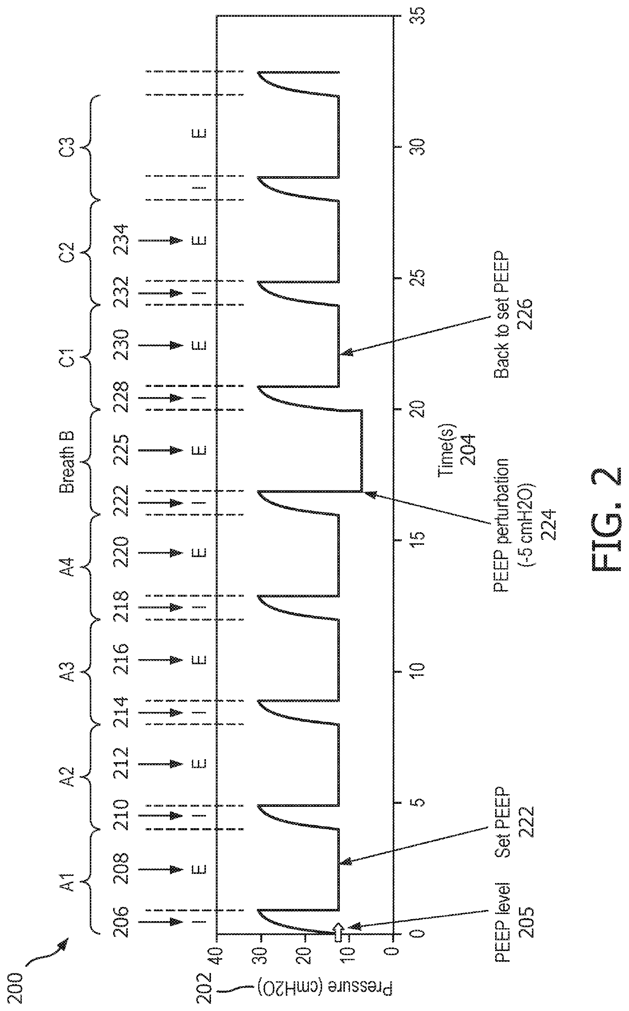 Expiratory flow limitation detection using pressure perturbations