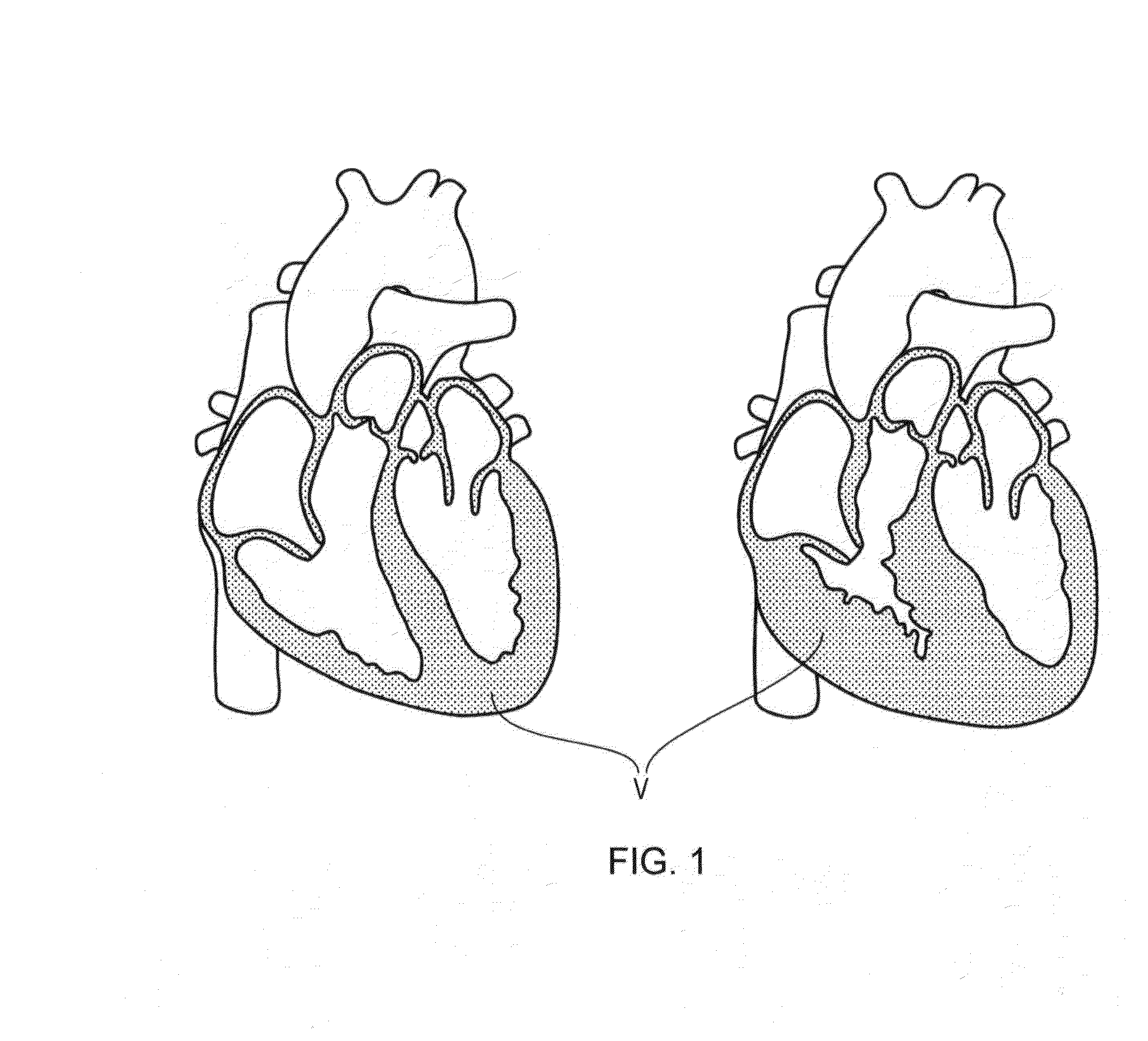 Volume rendering of medical images