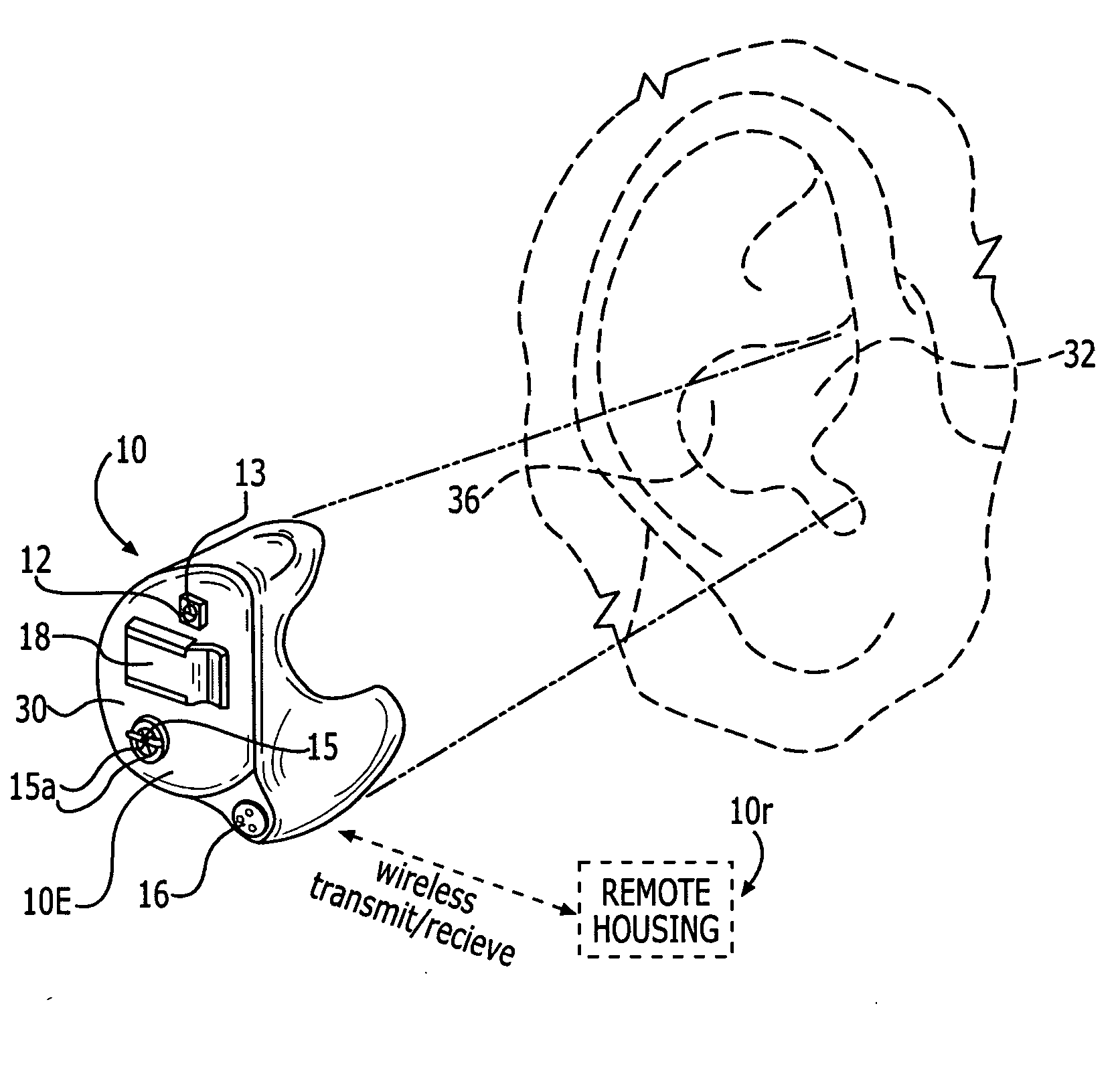 Methods and devices for treating non-stuttering speech-language disorders using delayed auditory feedback