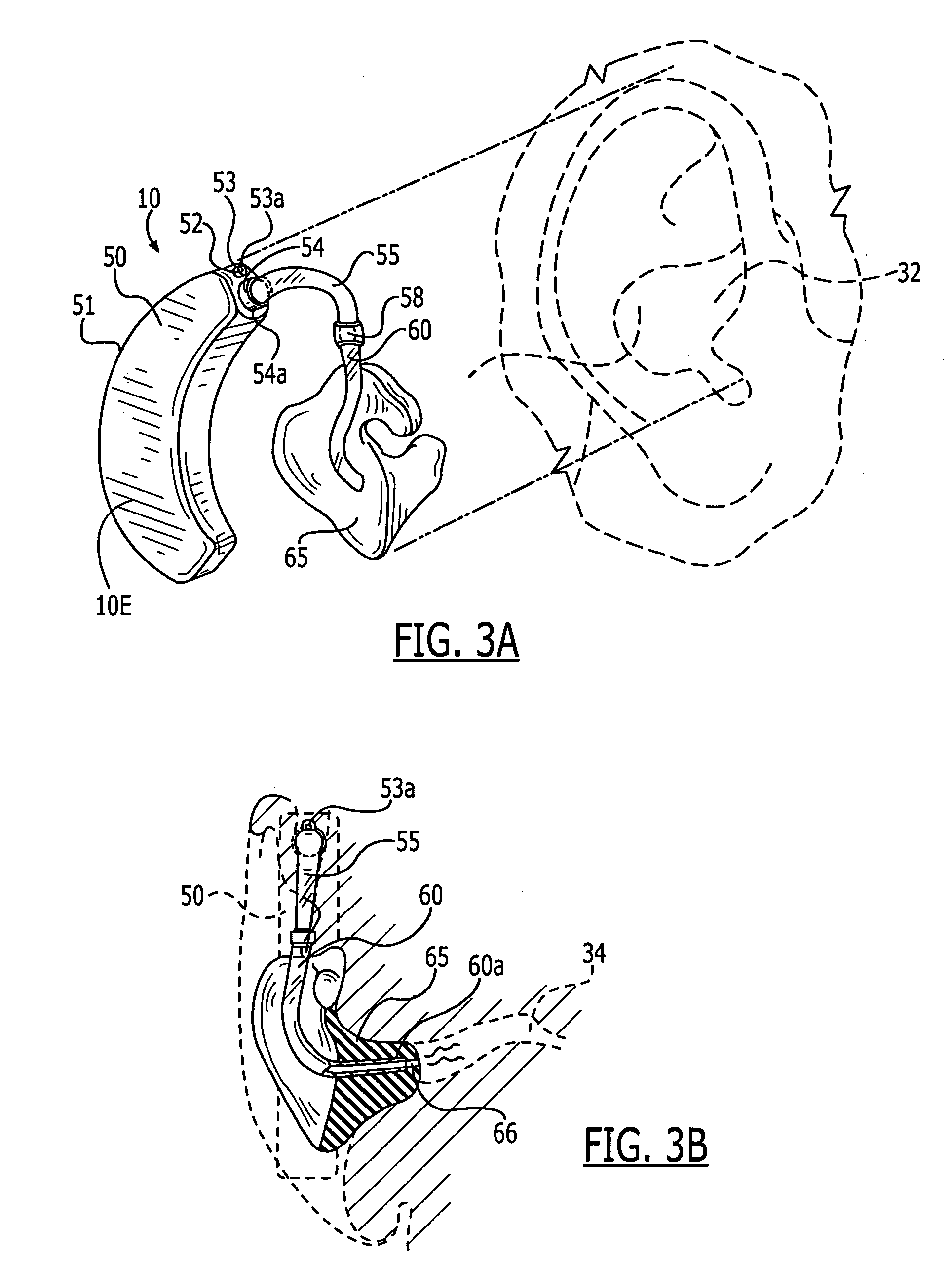 Methods and devices for treating non-stuttering speech-language disorders using delayed auditory feedback