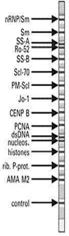 Kit for detecting antinuclear antibody spectrum related to autoimmune diseases (AIDs)