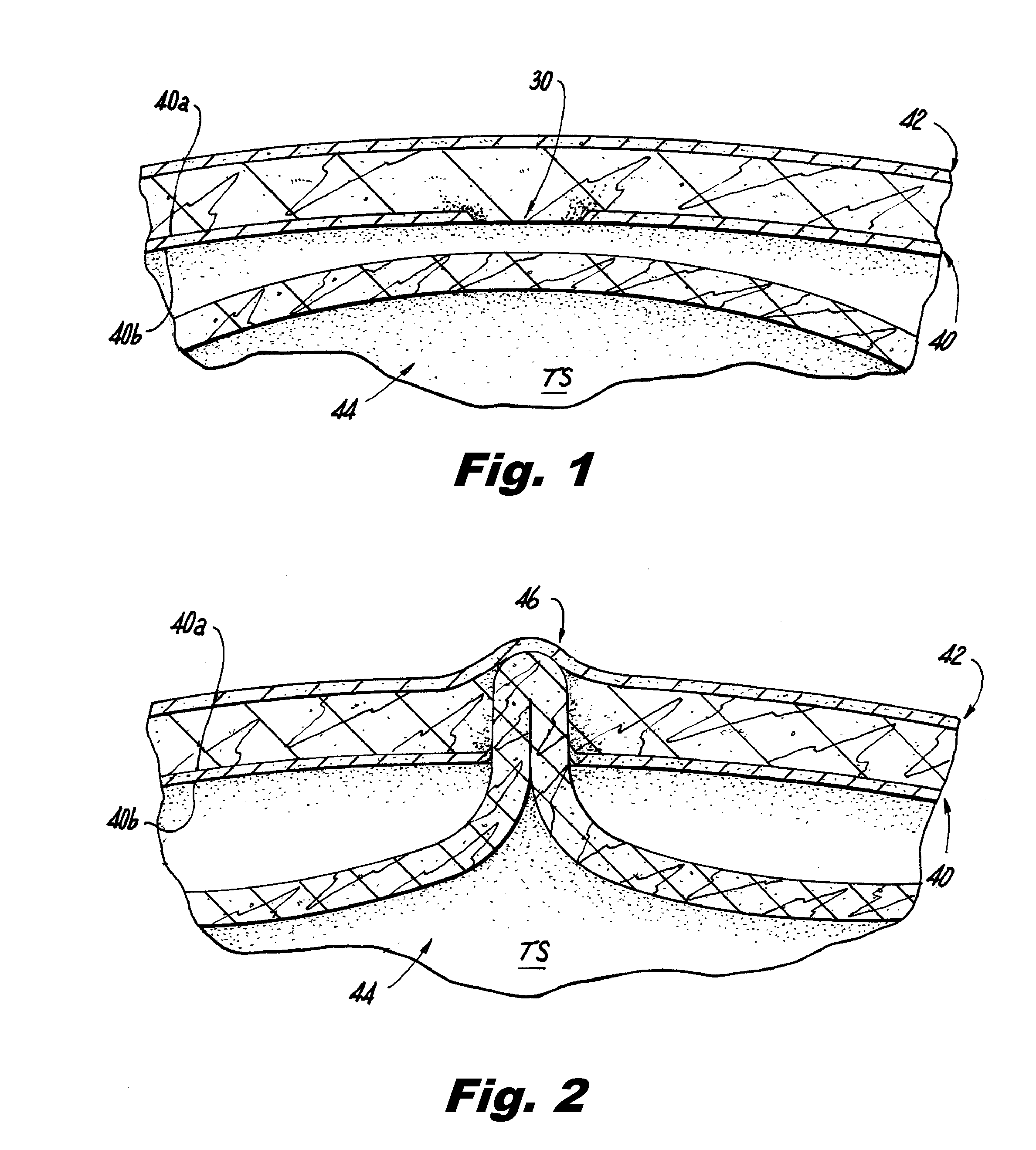 Methods of using light to repair hernia defects