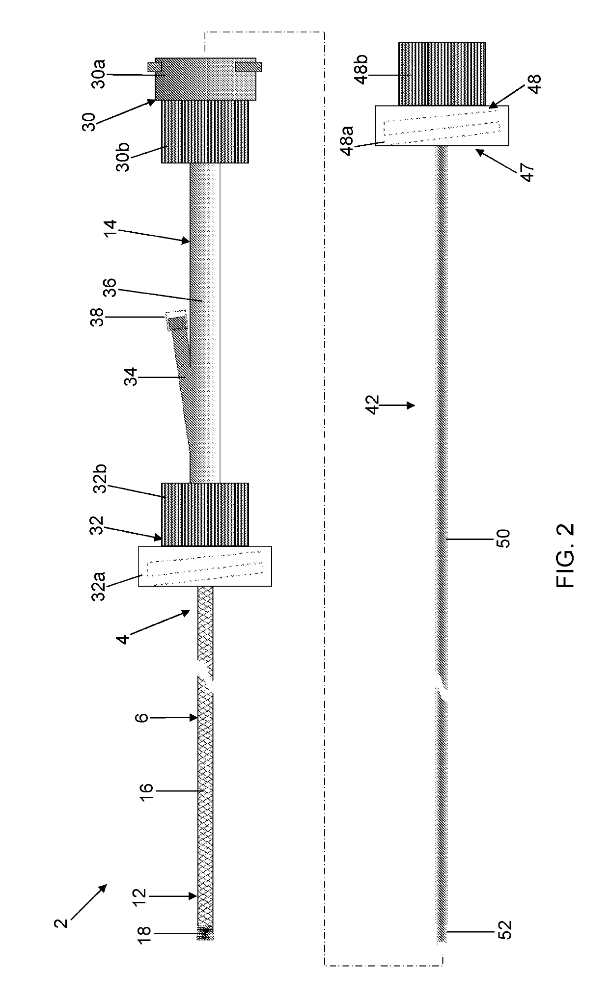 Mini-Invasive Device for the Endourologic Treatment