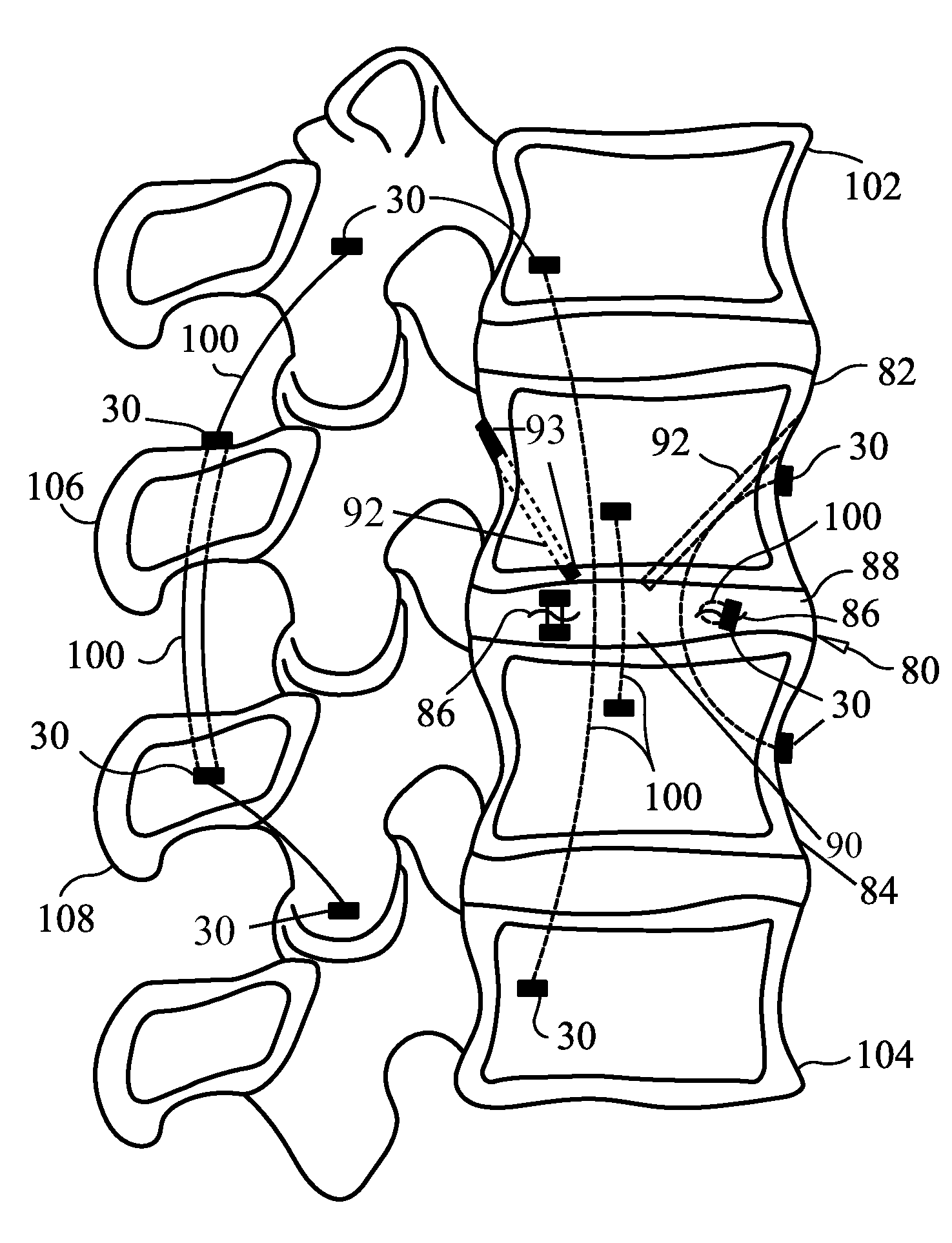 Expandable introducer system and methods