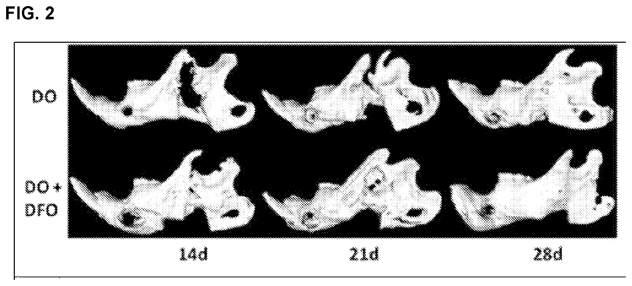 Devices, compositions and related methods for accelerating and enhancing bone repair