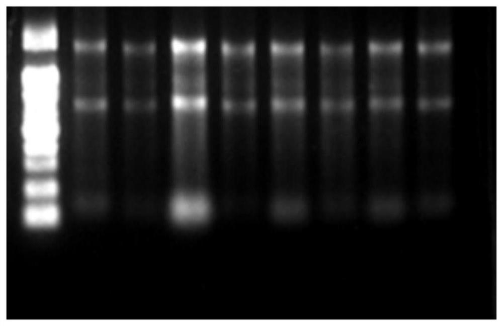 Detection kit taking AKR1C1 as detection target and use method of detection kit