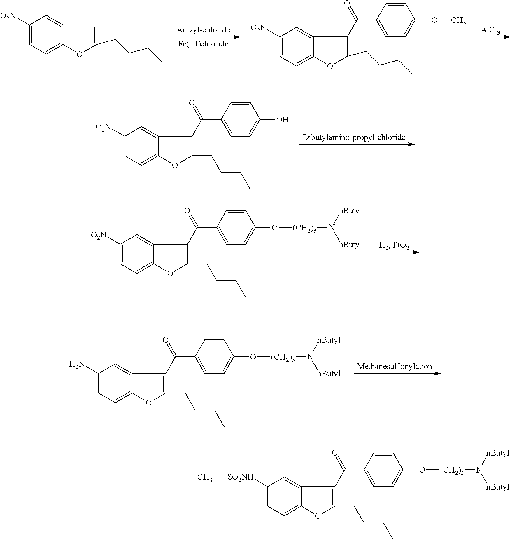 Process for preparation of dronedarone by removal of hydroxyl group