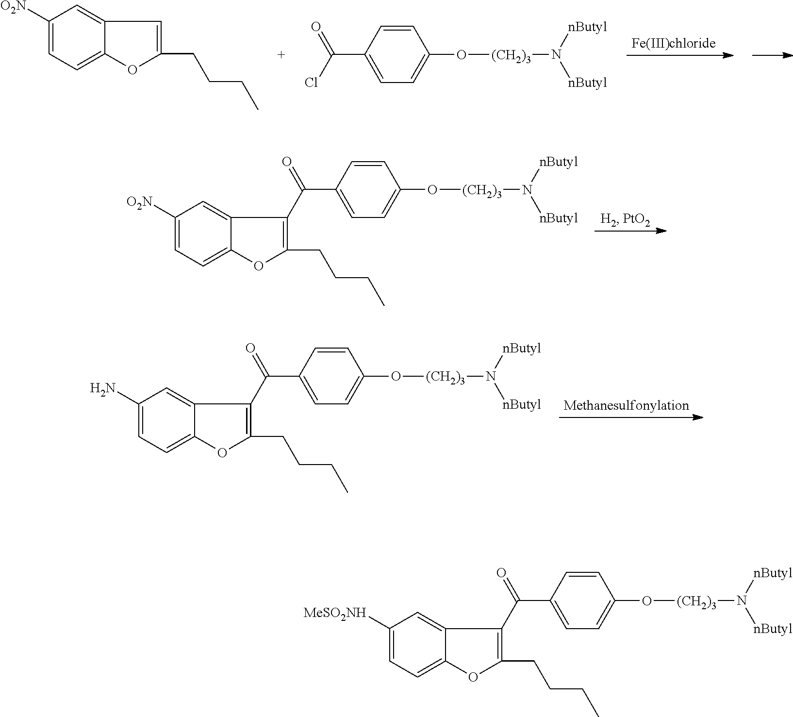 Process for preparation of dronedarone by removal of hydroxyl group