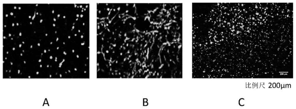 3D bioprinted skin tissue model