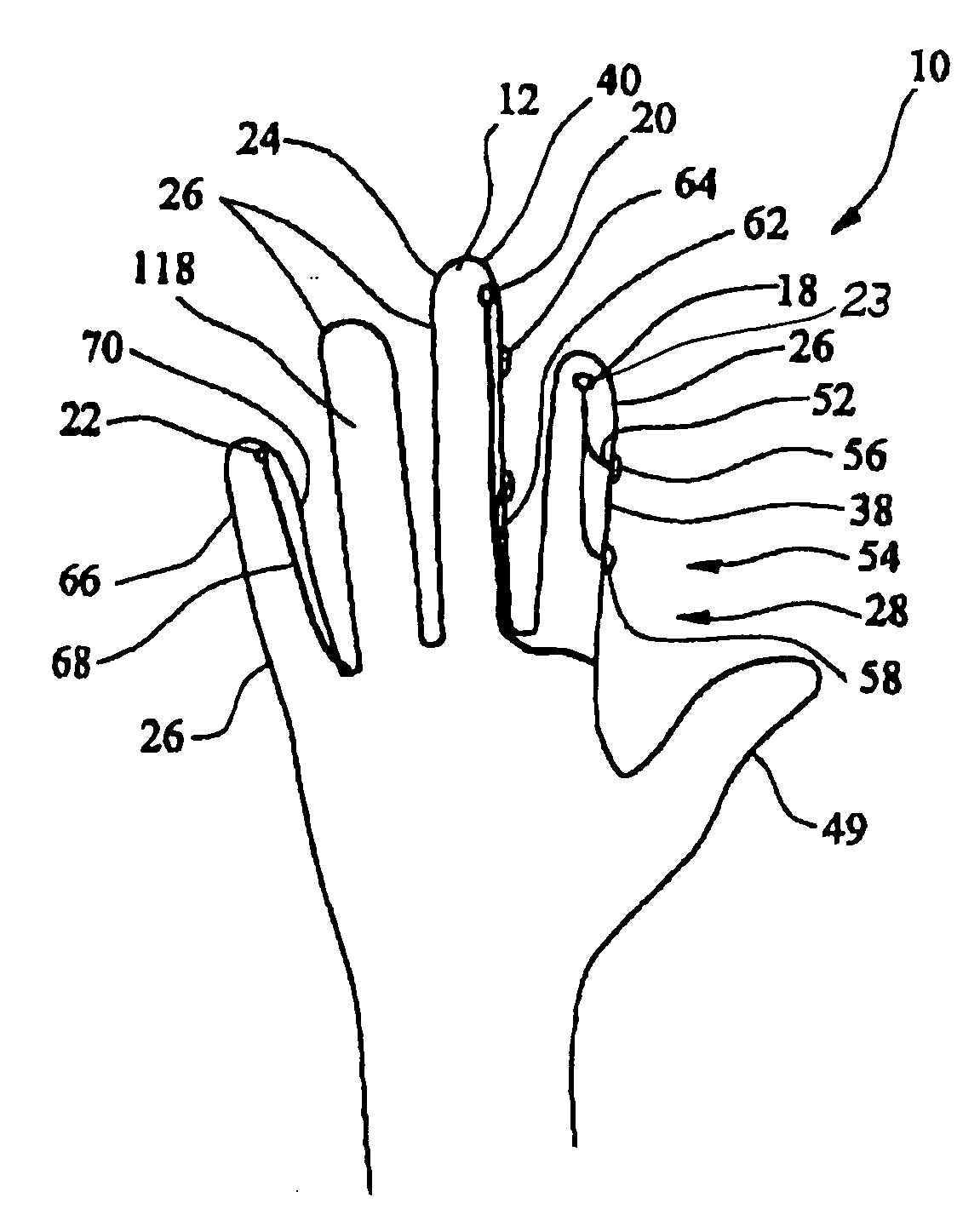 Surgical glove system