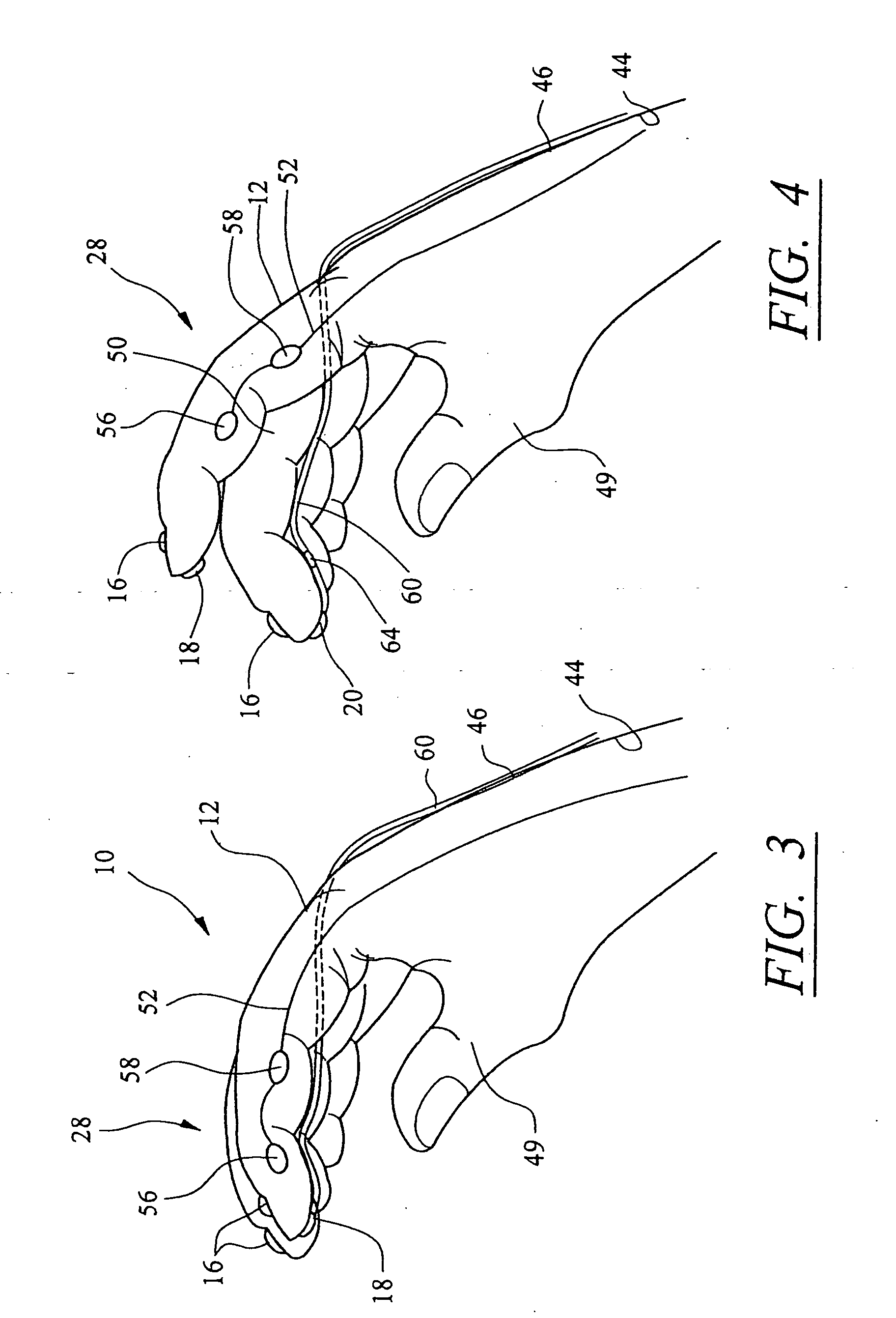 Surgical glove system