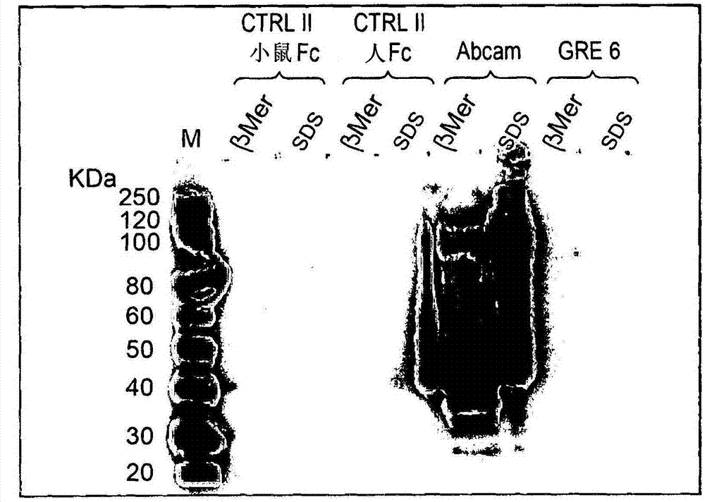 A human monoclonal antibody against the vp1 protein of jc virus