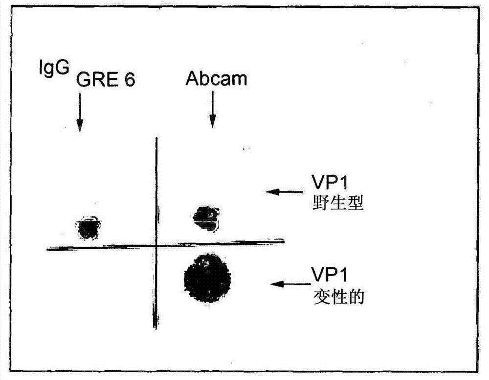 A human monoclonal antibody against the vp1 protein of jc virus