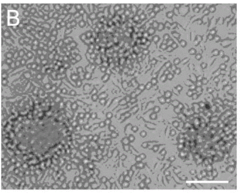 Method for preparing autologous hematopoietic stem cells, kit, the stem cells and application