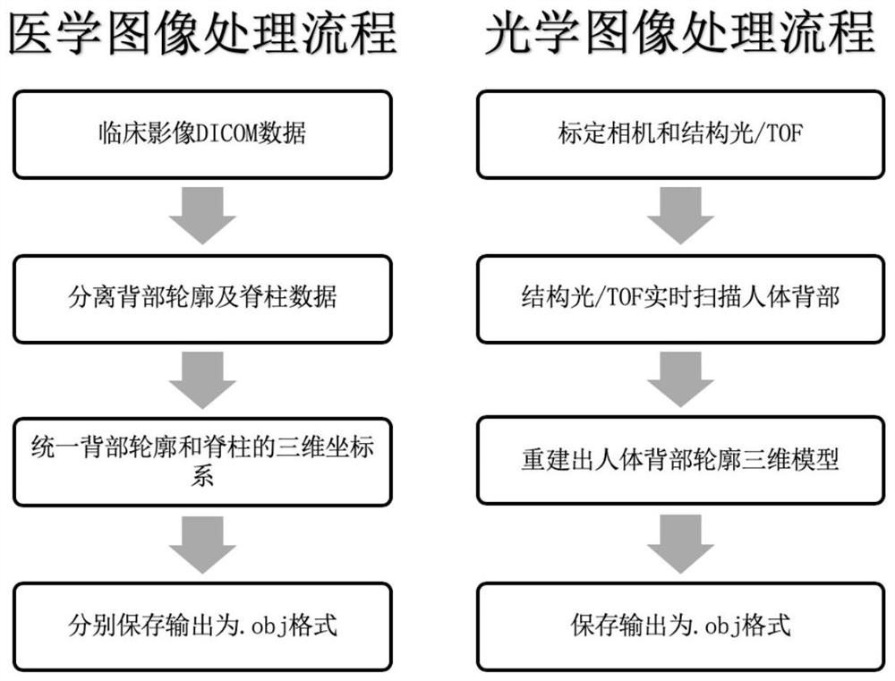 A radiation-free percutaneous spine localization method based on optical scanning automatic contour segmentation and matching