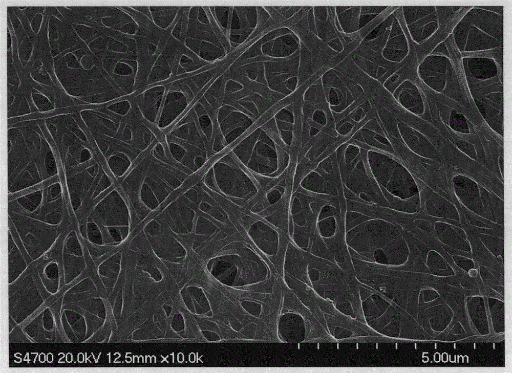 A kind of preparation method of sodium alginate-chitosan nano-scale medical dressing