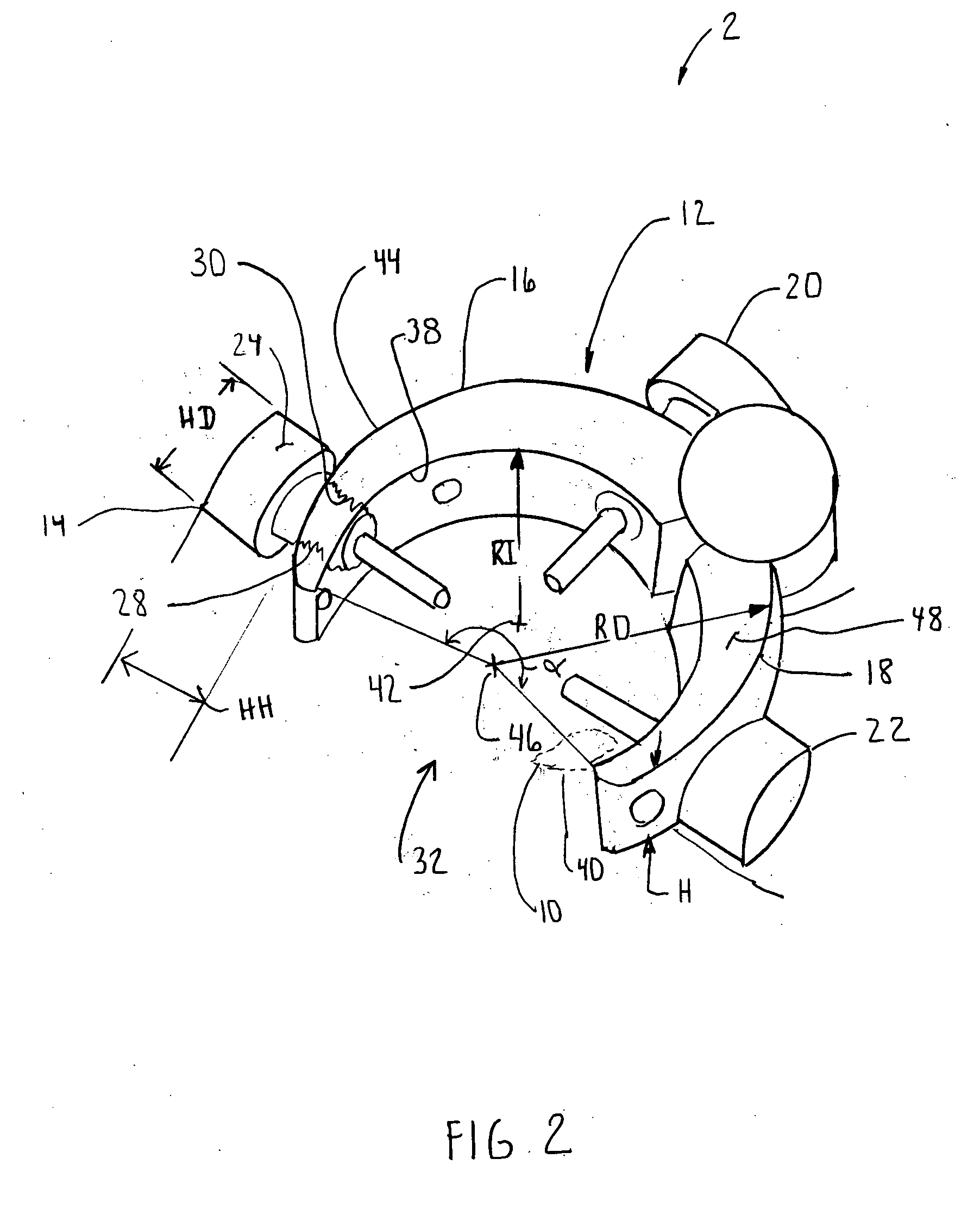 Shoulder Positioning fixture, trials and associated method