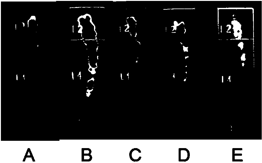 Preparation method of phosphorylated krill peptide for preventing and treating osteoporosis