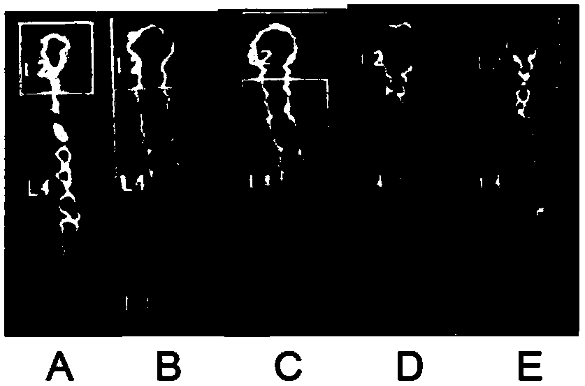 Preparation method of phosphorylated krill peptide for preventing and treating osteoporosis