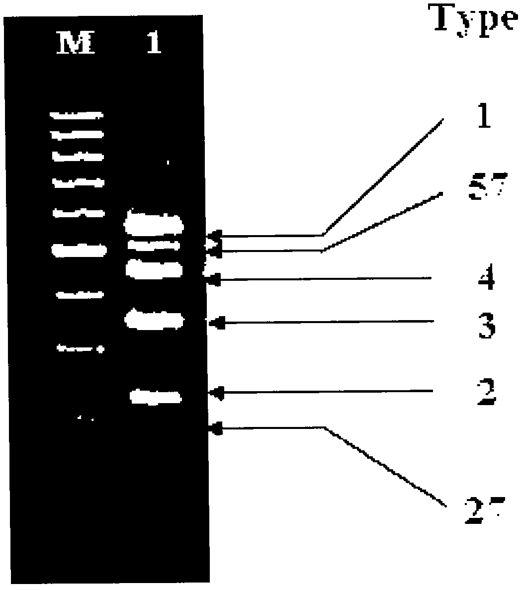 Primer and probe for detection of human papillomavirus, and detection method of human papillomavirus using same