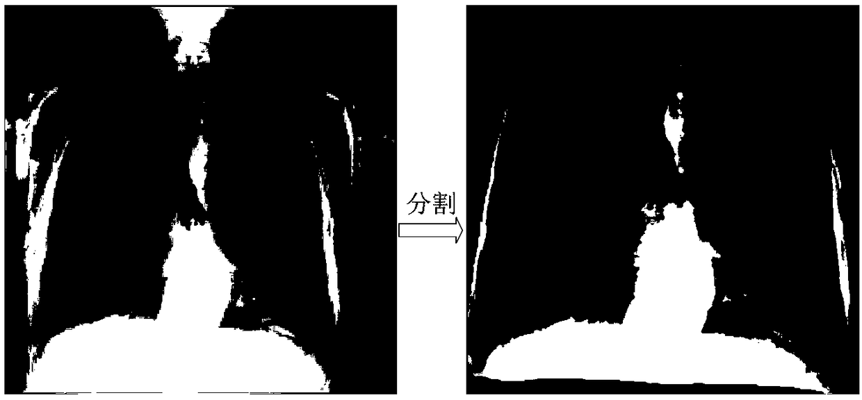 Construction method and application of thoracic disease detection model