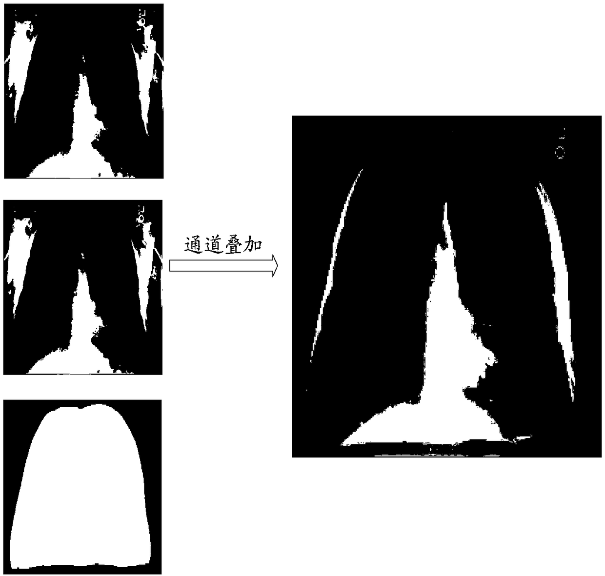 Construction method and application of thoracic disease detection model