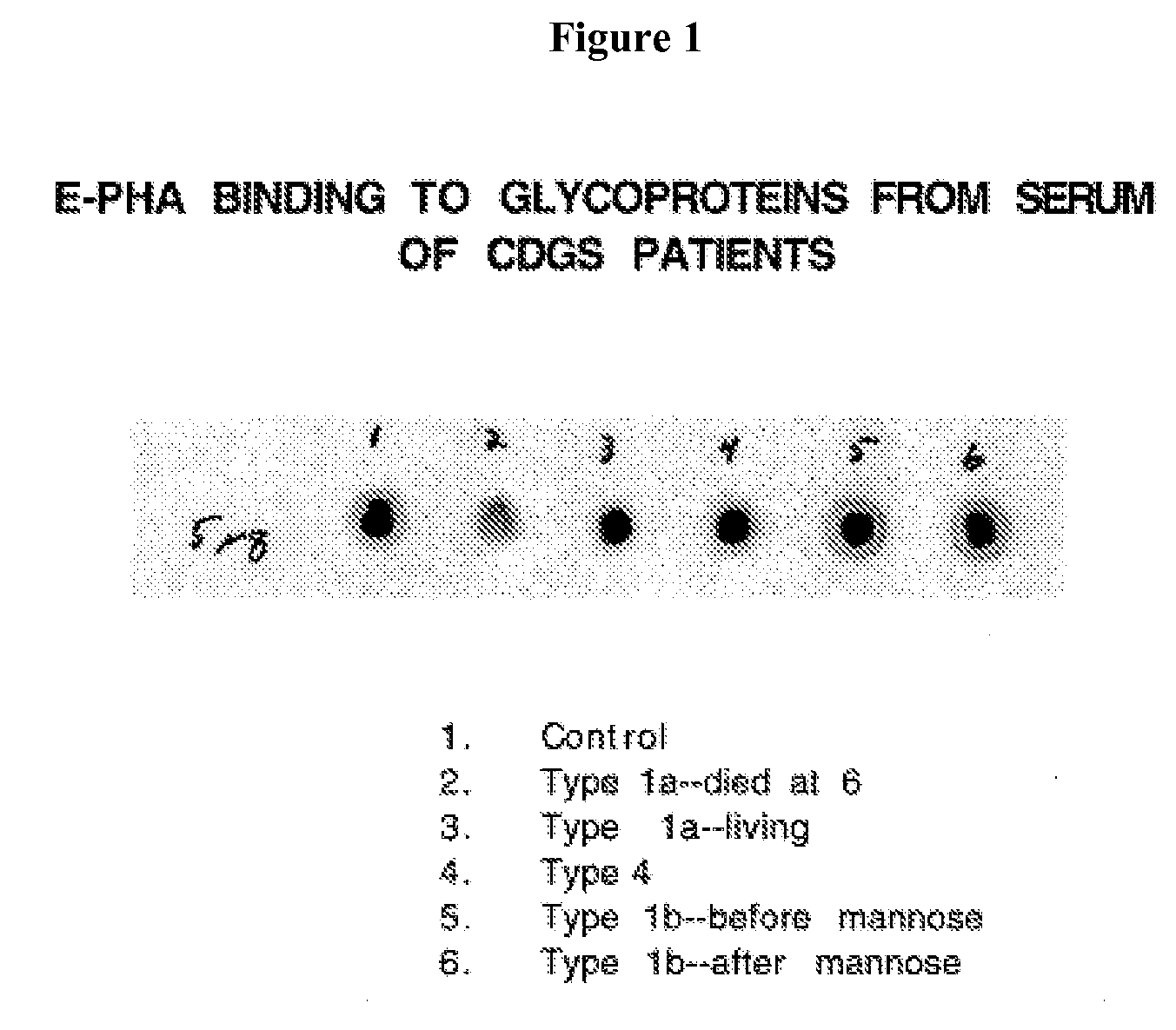 Diagnosis of human glycosylation disorders