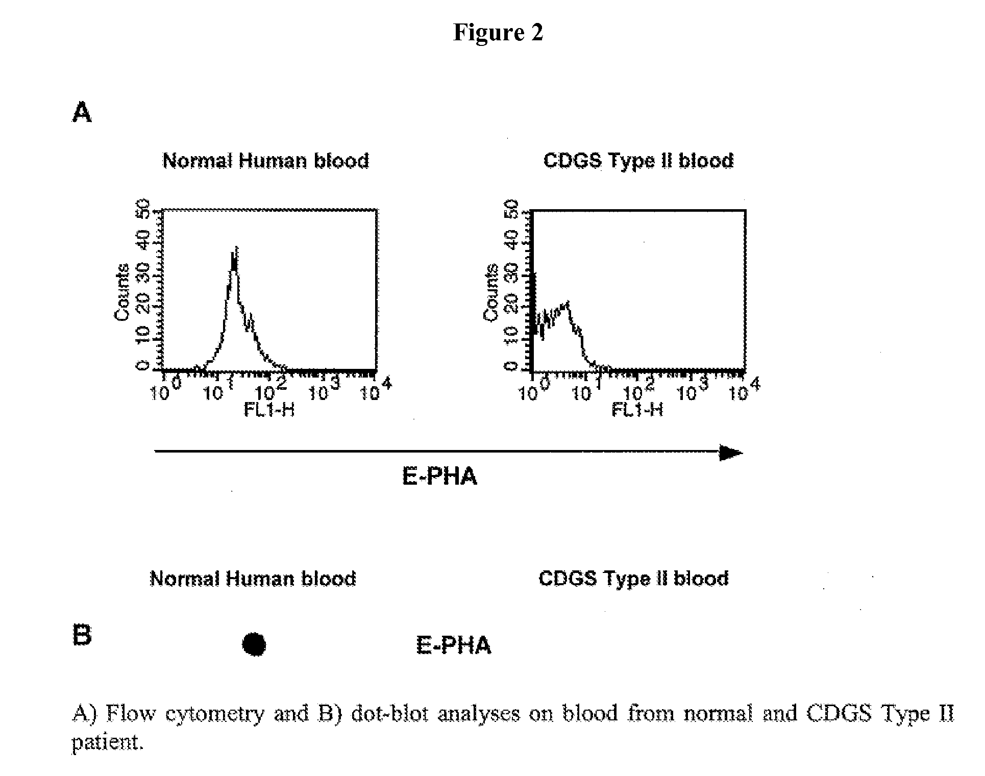 Diagnosis of human glycosylation disorders